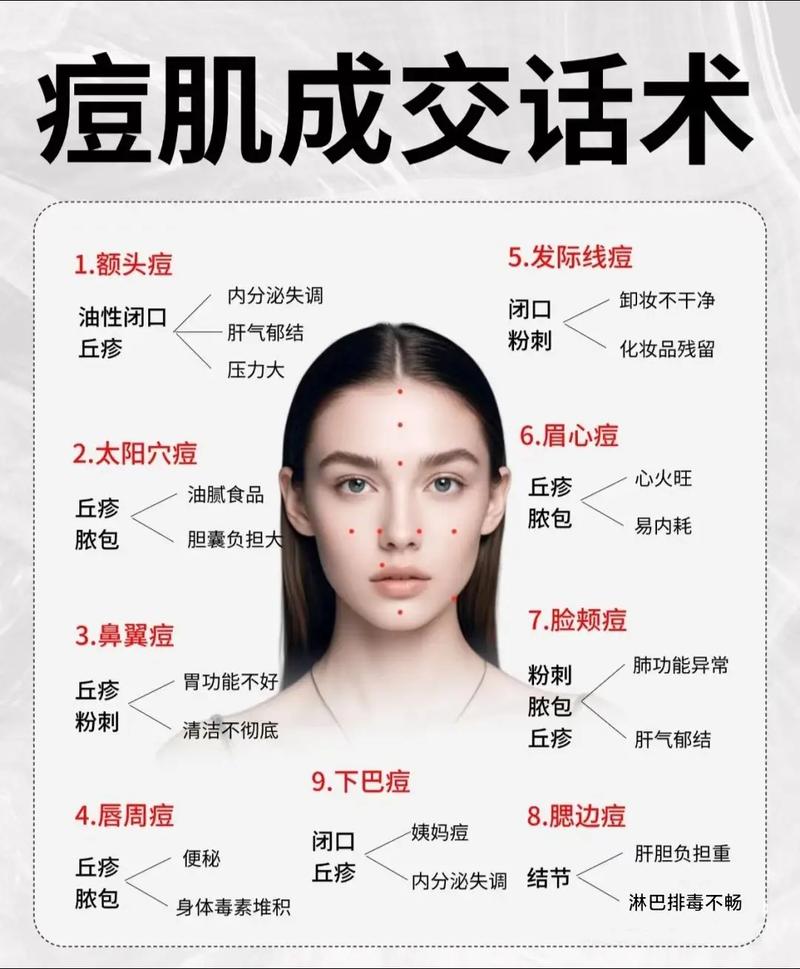 痘痘肌先控油还是先祛痘-图2