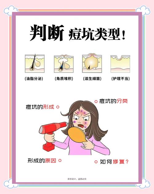 痘痘肌先控油还是先祛痘-图3