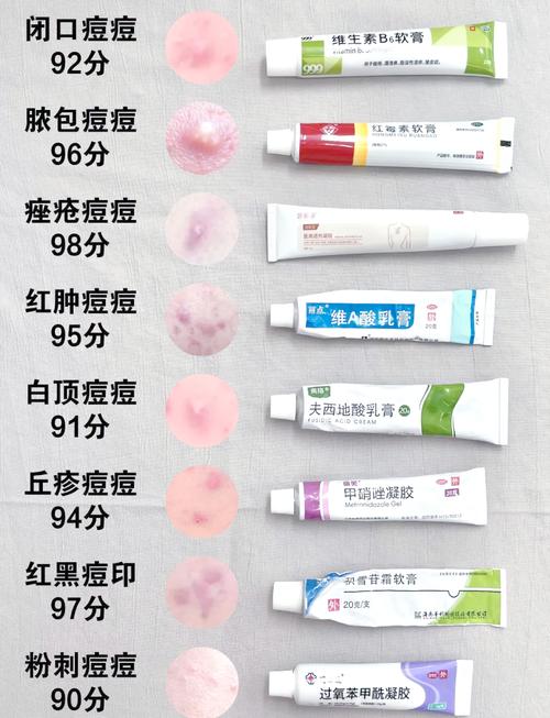 祛痘印什么产品最有效？-图1