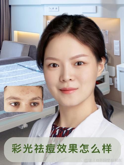 光学祛痘后还会复发吗？-图2