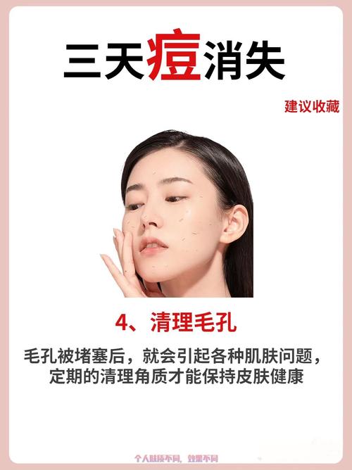 白醋祛痘方法是什么？-图2