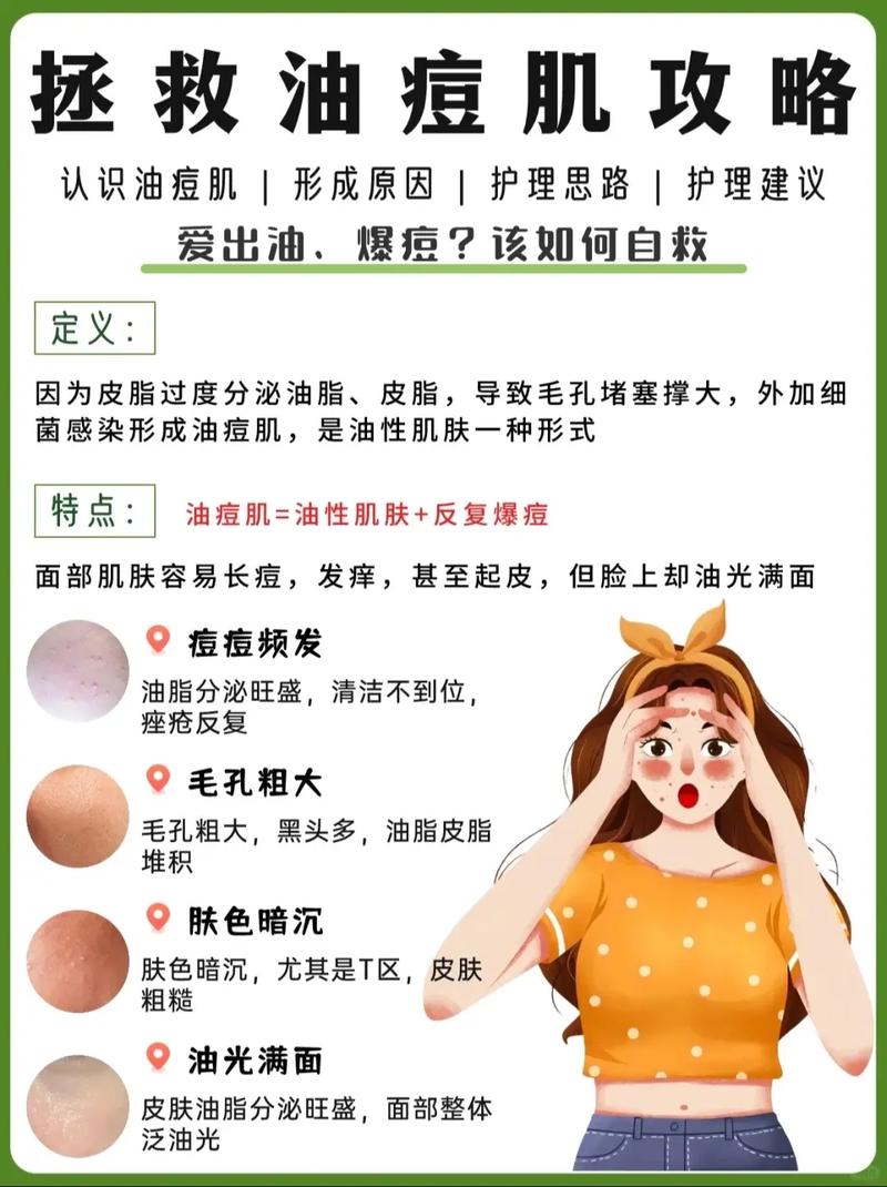 北京激光祛痘后，如何正确护理才有效？-图3