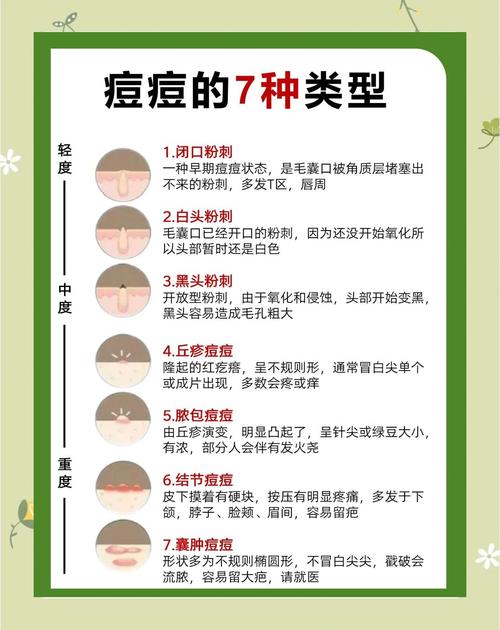 脸上痘痘怎么快速祛痘？-图1