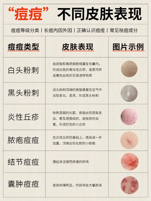 5 5祛痘系列护肤价格多少？-图3