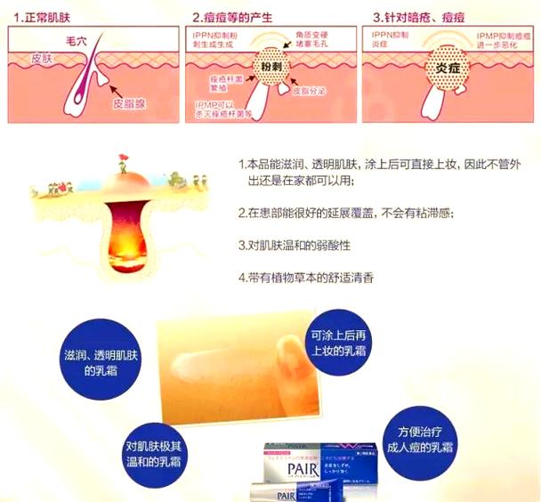 狮王祛痘膏正品验证方法有哪些？-图1