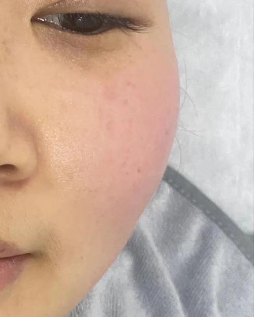 Skin79护肤品效果真的好吗？-图2