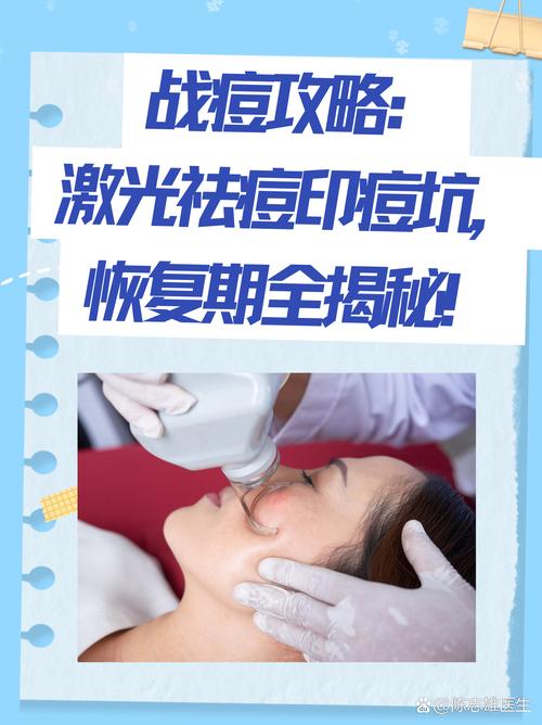 激光祛痘效果能维持多久？-图2