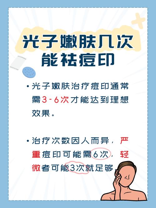 激光祛痘效果能维持多久？-图3