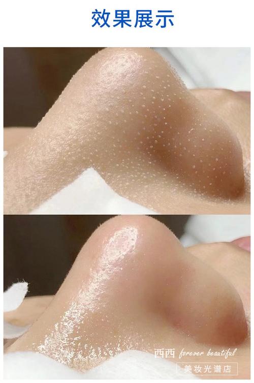 毛孔大黑头困扰，选什么护肤品？-图3