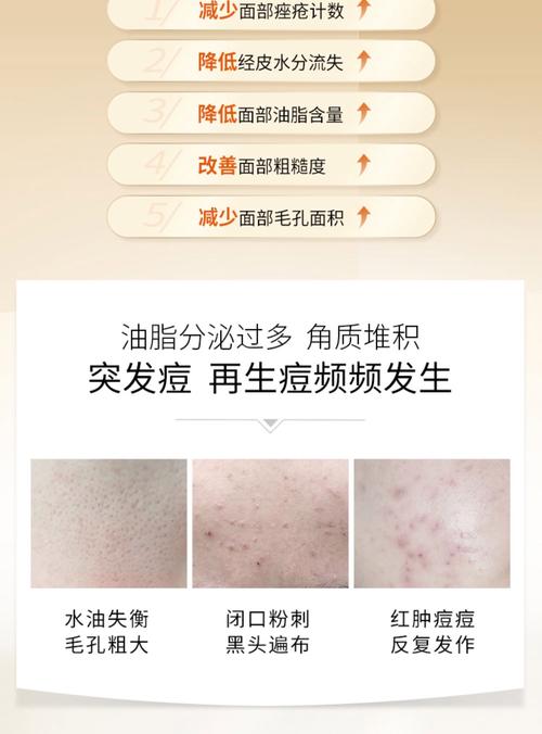 祛痘化妆品真的能去痘吗？-图1