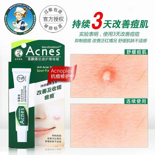 曼秀雷敦祛痘啫喱效果究竟如何？-图1