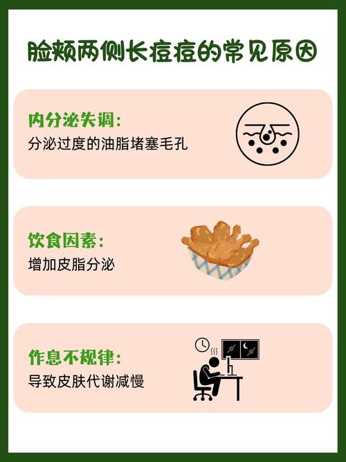 为什么用祛痘面膜会长痘-图1