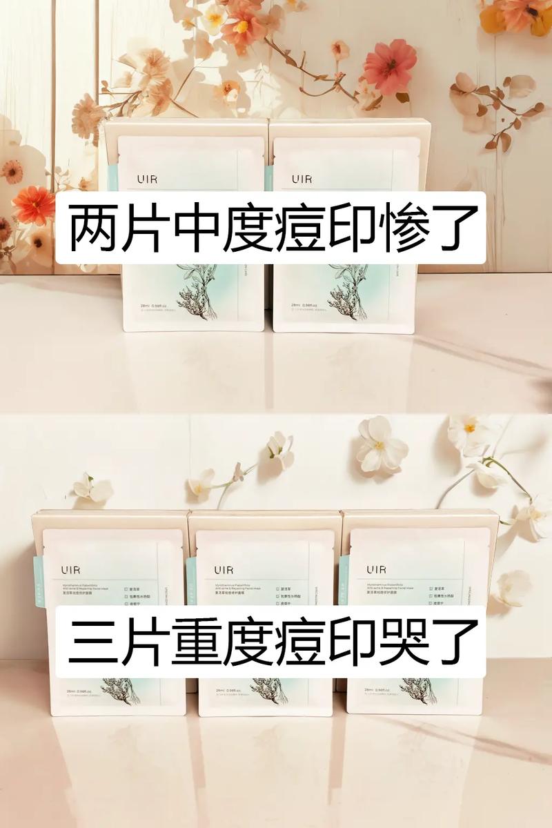 为什么用祛痘面膜会长痘-图2