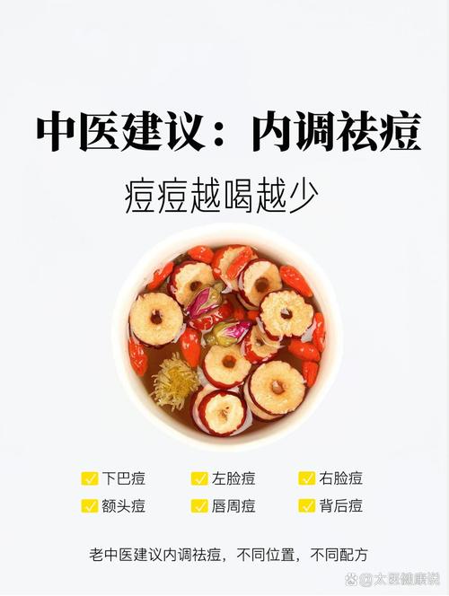 喝中药祛痘会先出痘多吗-图2