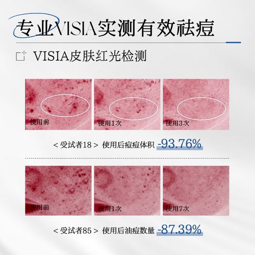 祛痘坑痘印面膜真的有效吗？-图3