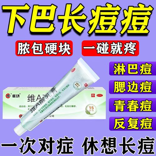 下巴痘印难消？如何有效祛除？-图2