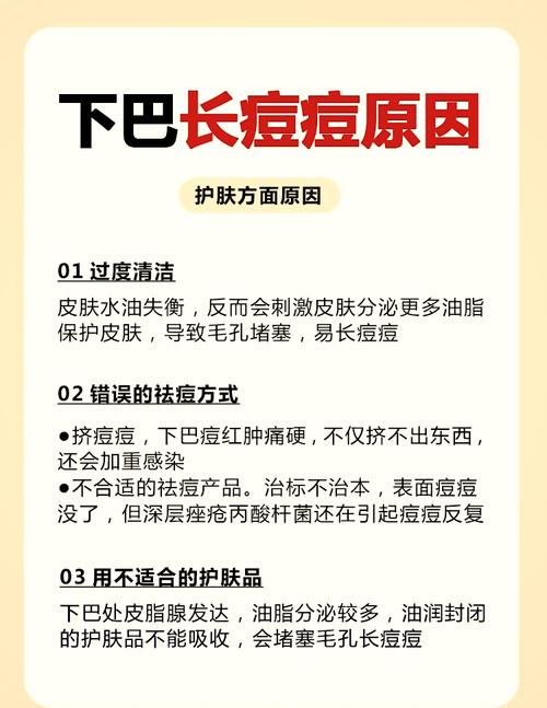 下巴痘印难消？如何有效祛除？-图3