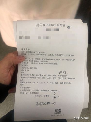 点阵激光 祛痘记录_-图1