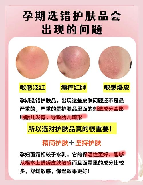 怀孕期间护肤品可以用吗-图2