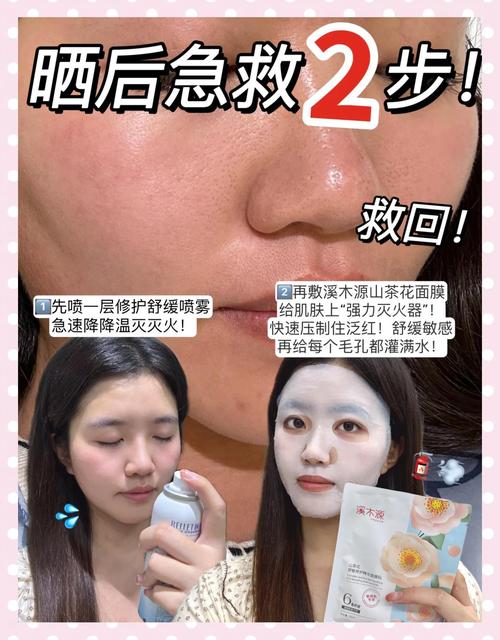 茶树面膜祛痘真的有效吗？-图3