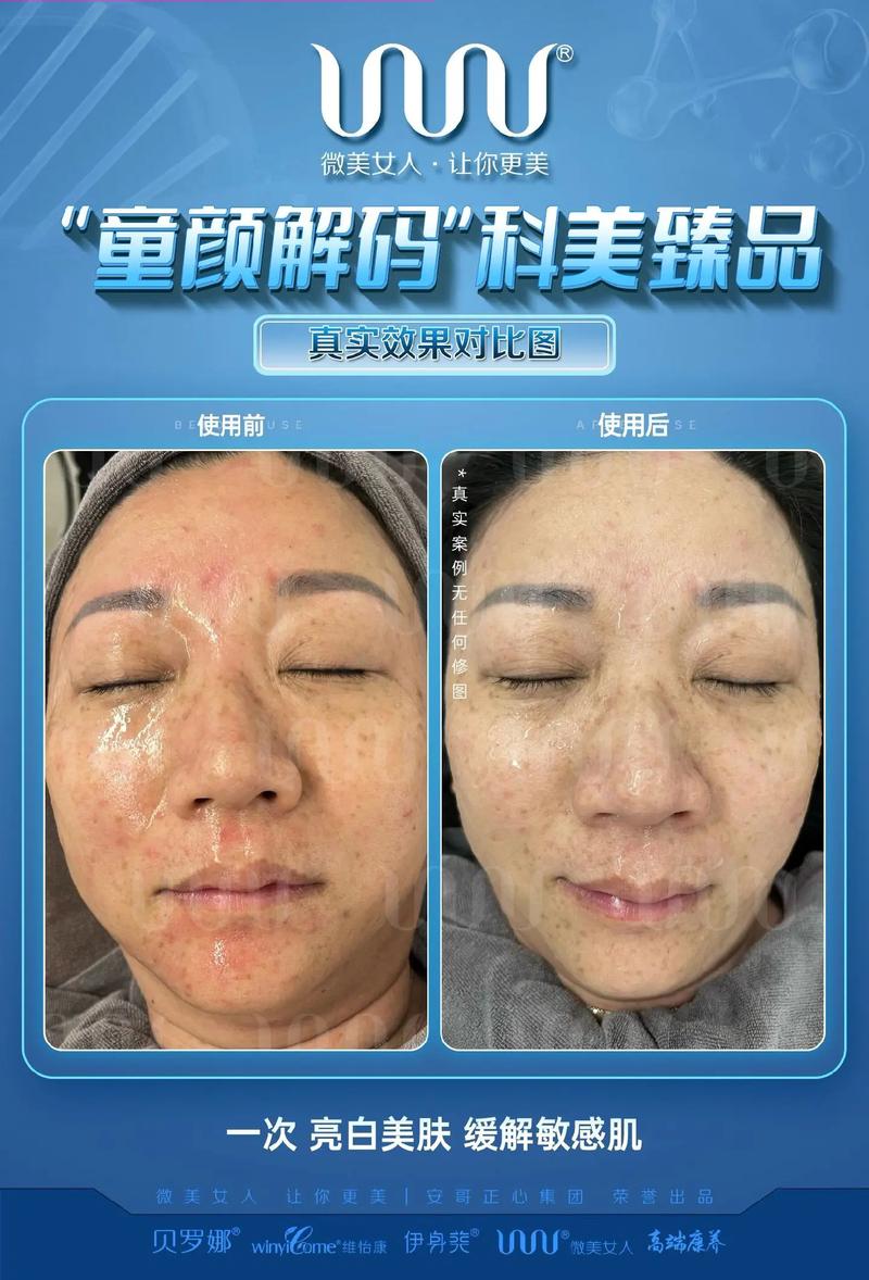 理肤泉和薇姿祛痘哪个好-图2