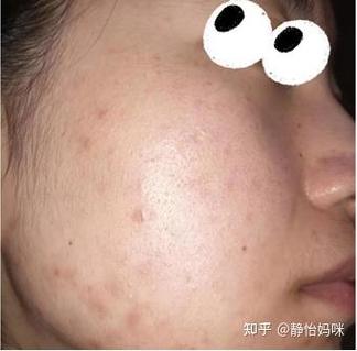 孕妇能用AT护肤品吗？成分安全吗？-图3