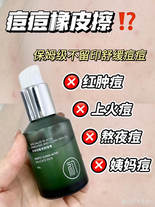 伊思ac祛痘系列效果真的好吗？-图1