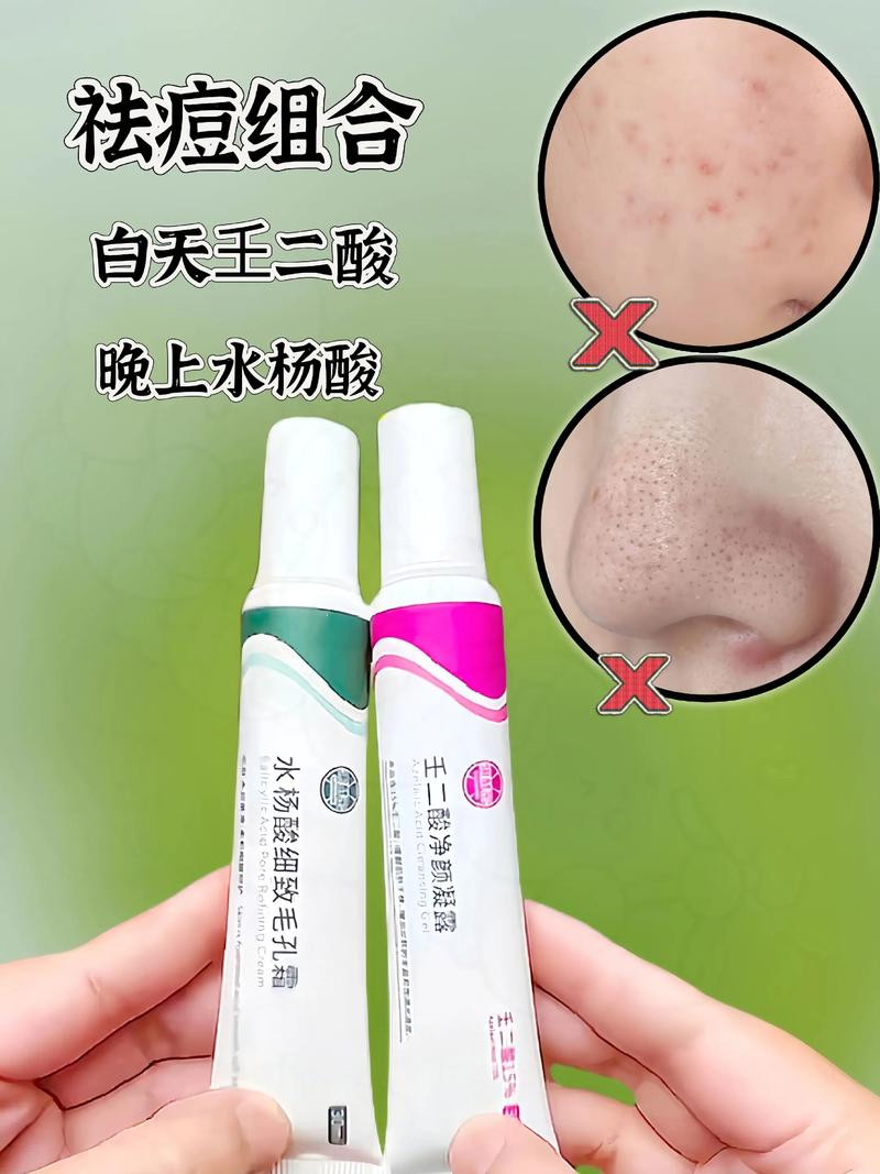 十款含水杨酸祛痘护肤品-图1