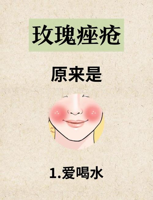 快速祛痘印最有效的方法-图2