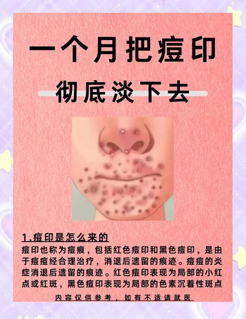 祛痘印小窍门真的简单有效吗？-图2