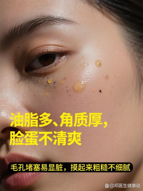 白醋祛痘洗脸怎么用才正确?-图2 白醋祛痘洗脸怎么用才正确?-图2