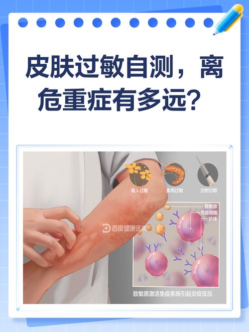 护肤品过敏怎么测？-图2