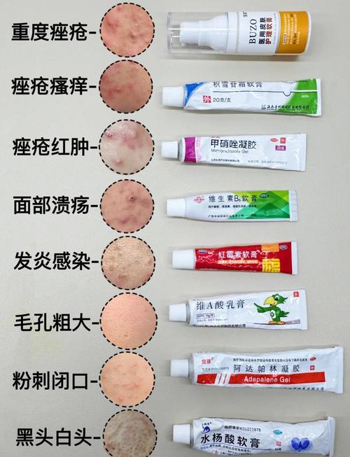 八十多的祛痘膏有哪些-图1