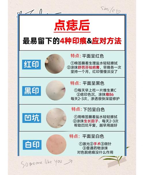 祛痣后多久可以用护肤品-图2