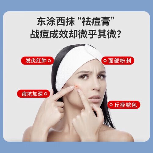 红霉素膏能祛痘印吗？-图2