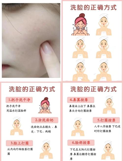 清洁盐水洗脸能祛痘吗?-图2 清洁盐水洗脸能祛痘吗?-图2