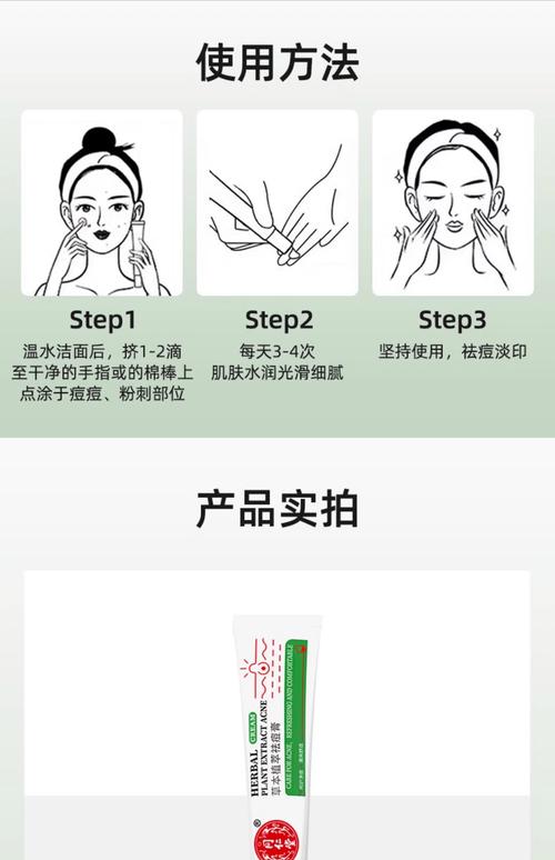 祛痘霜和洗面奶，哪个先用哪个后？-图1