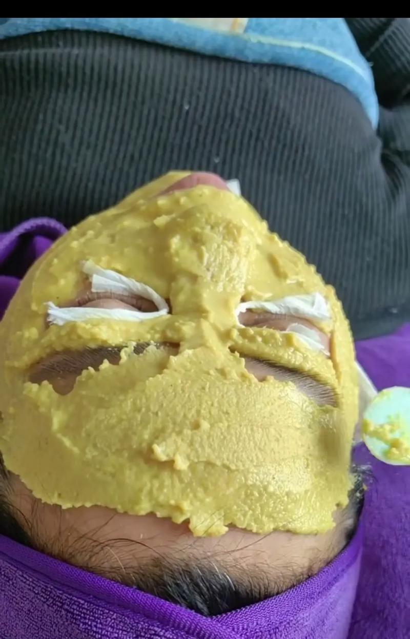 中药面膜能祛痘坑吗？-图2