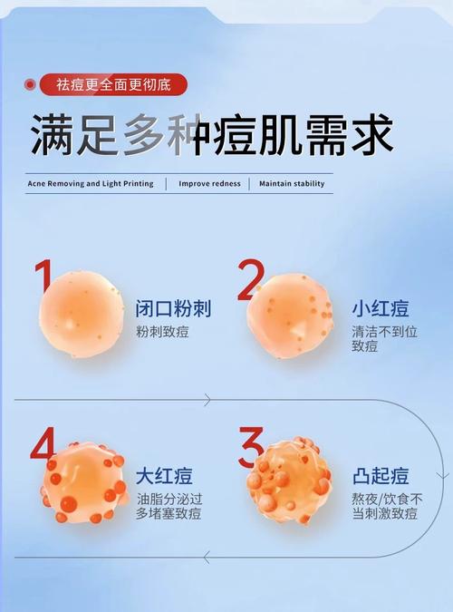 屈臣氏祛痘贴真的有用吗？-图2