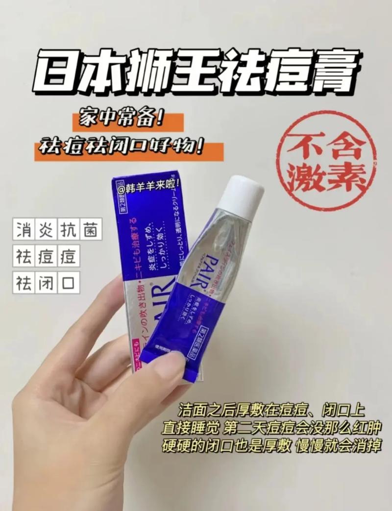 花王祛痘膏效果真有那么好吗？-图1