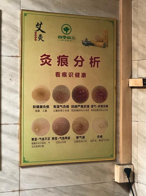 艾灸灰祛痘印怎么用才有效？-图3