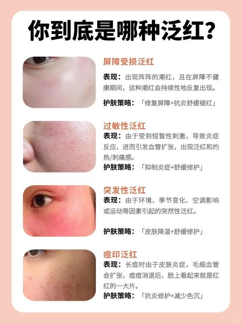 脸上过敏，护肤品还能用吗？-图1