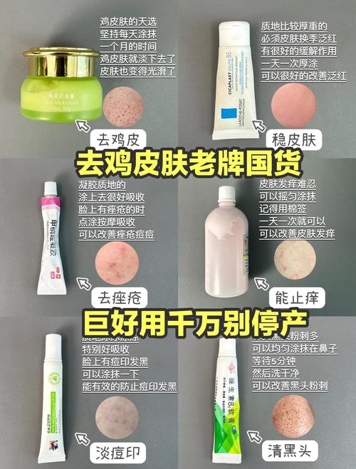 玉容散能治角质薄吗？-图2