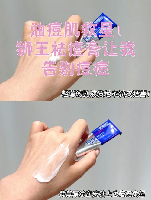 狮王祛痘膏怎么挤？正确方法是什么？-图1