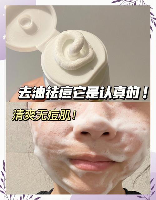 青少年洗面奶控油祛痘，选对了吗？-图3