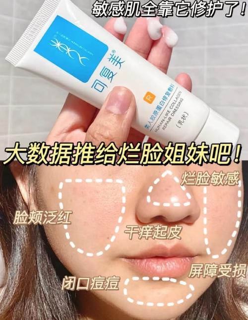 双向祛痘消痕霜早上擦能用吗？-图2