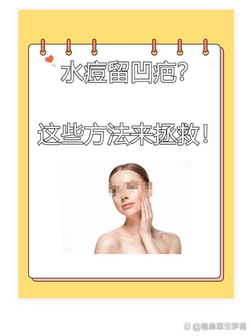 祛痘水能直接敷痘痘上吗？-图3