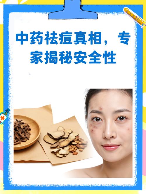 中药祛痘真的有效吗？-图2