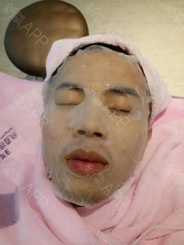 长沙红蓝光祛痘著美莱效果如何？-图1