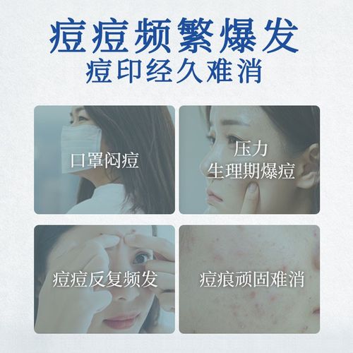 祛痘平衡霜试用装多少钱？-图1